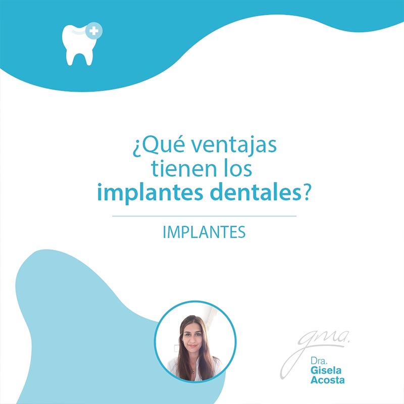 Implantes dentales en Córdoba