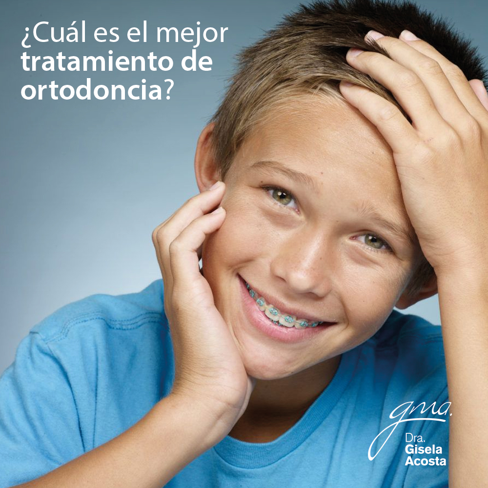 cuál es el mejor tratamiento de ortodoncia?